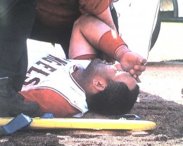 kendry-morales-ankle-2