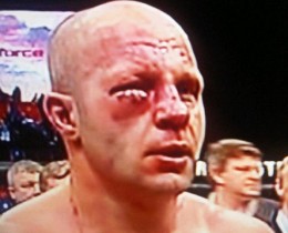 fedor-eye2