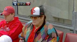 Pete-Rose-Jacket