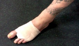 neil-melanson-toe