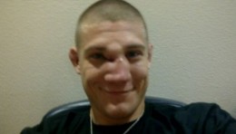 Ryan-McGillivray-Broken-Nose