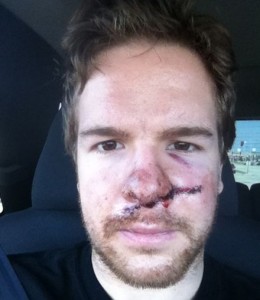 Ryan-Duncan-Skate-to-Face