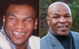 mike-tyson-tooth