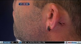 matt-schaub-ear