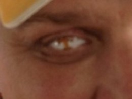 tennessee-vols-glass-eye-1