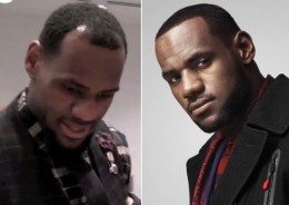 lebron-james-hairline
