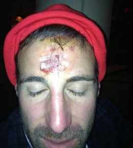 Mike-Vrabel-headbutt-stitches