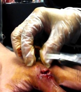 nonito-donaire-knuckle