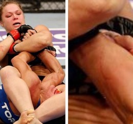 liz-carmouche-bite-marks-3
