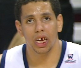 brad-waldow-tooth-1