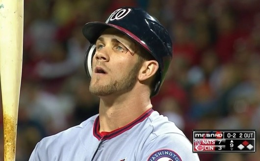 Washington Nationals' Bryce Harper Suffers Cut Above Eye Taking