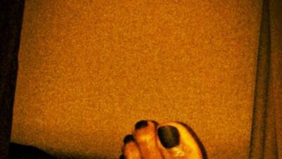 Dwyane Wade black toenails