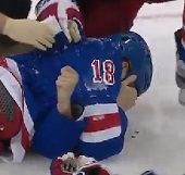 Marc Staal hit in face by puck 