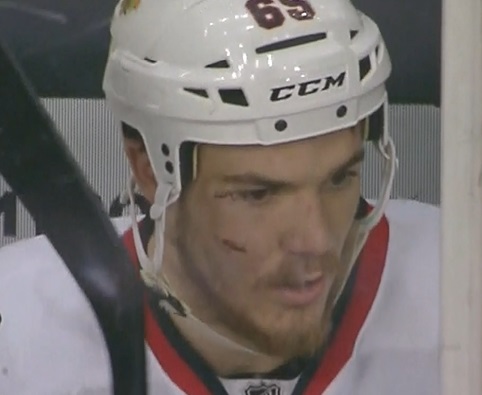 Did you know: Blackhawks' Andrew Shaw sold his stitches from Stanley Cup –  NBC Sports Chicago