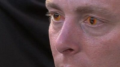 Brandon Inge color contacts