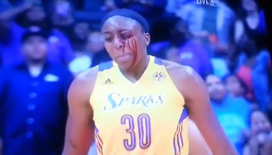 Candace Parker Recounts the Parker-Ogwumike Head Bump 