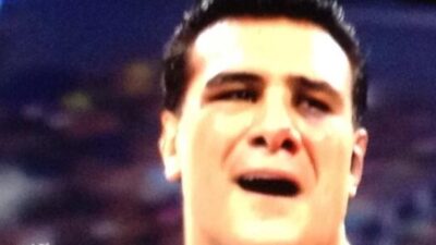 Alberto del Rio black eye