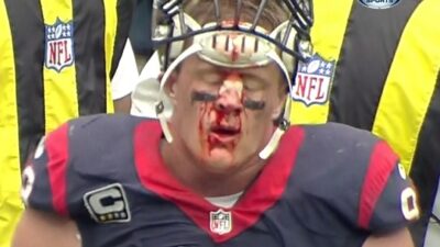 JJ Watt blood face