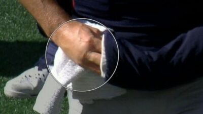 Tom Brady hand injury