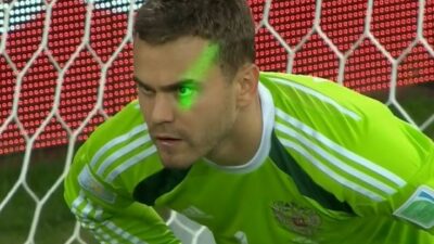Igor Akinfeev laser