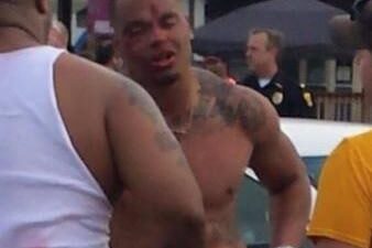 Dak Prescott beat up