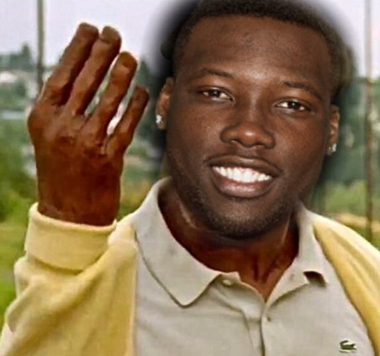 Jason Pierre-Paul's garish reminder: My hand is a wreck