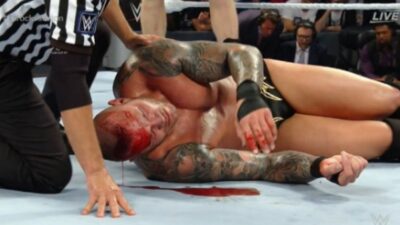 Randy Orton cut head
