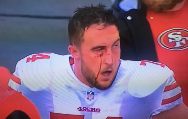49ers T Joe Staley Announces His Retirement from the NFL