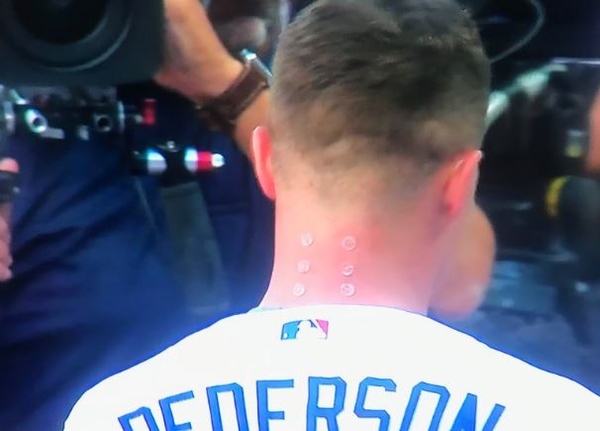 Twitter Went Nuts Trying To Figure Out What Was On Joc Pedersons Neck 
