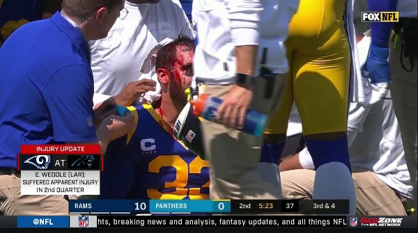 Rams' Eric Weddle bleeds from head after Christian McCaffrey hit him -  Sports Illustrated