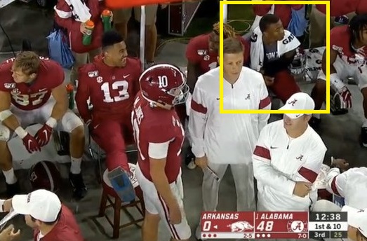 Alabama star WR DeVonta Smith required two surgical procedures to fix his  hand