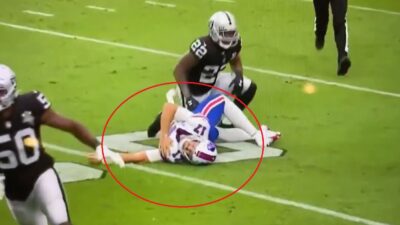Josh Allen shoulder