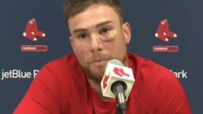 Christian Vazquez eye