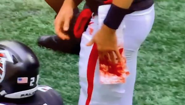 Matt Ryan's hand bleeding