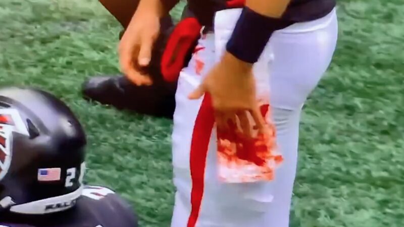 Matt Ryan's hand bleeding