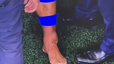 Saquon Barkley swollen ankle