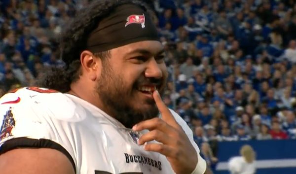 Vita Vea loses a tooth