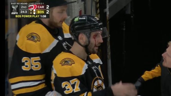 Patrick Bergeron left bloody after a high stick