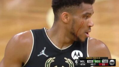 Giannis Antetokounmpo with blood dripping down