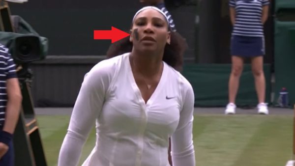 Serena Williams with tape on her face