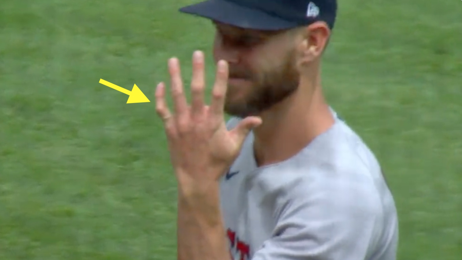 Video: Chris Sale exits game after line drive off pitching hand