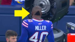 Von Miller with a funny haircut