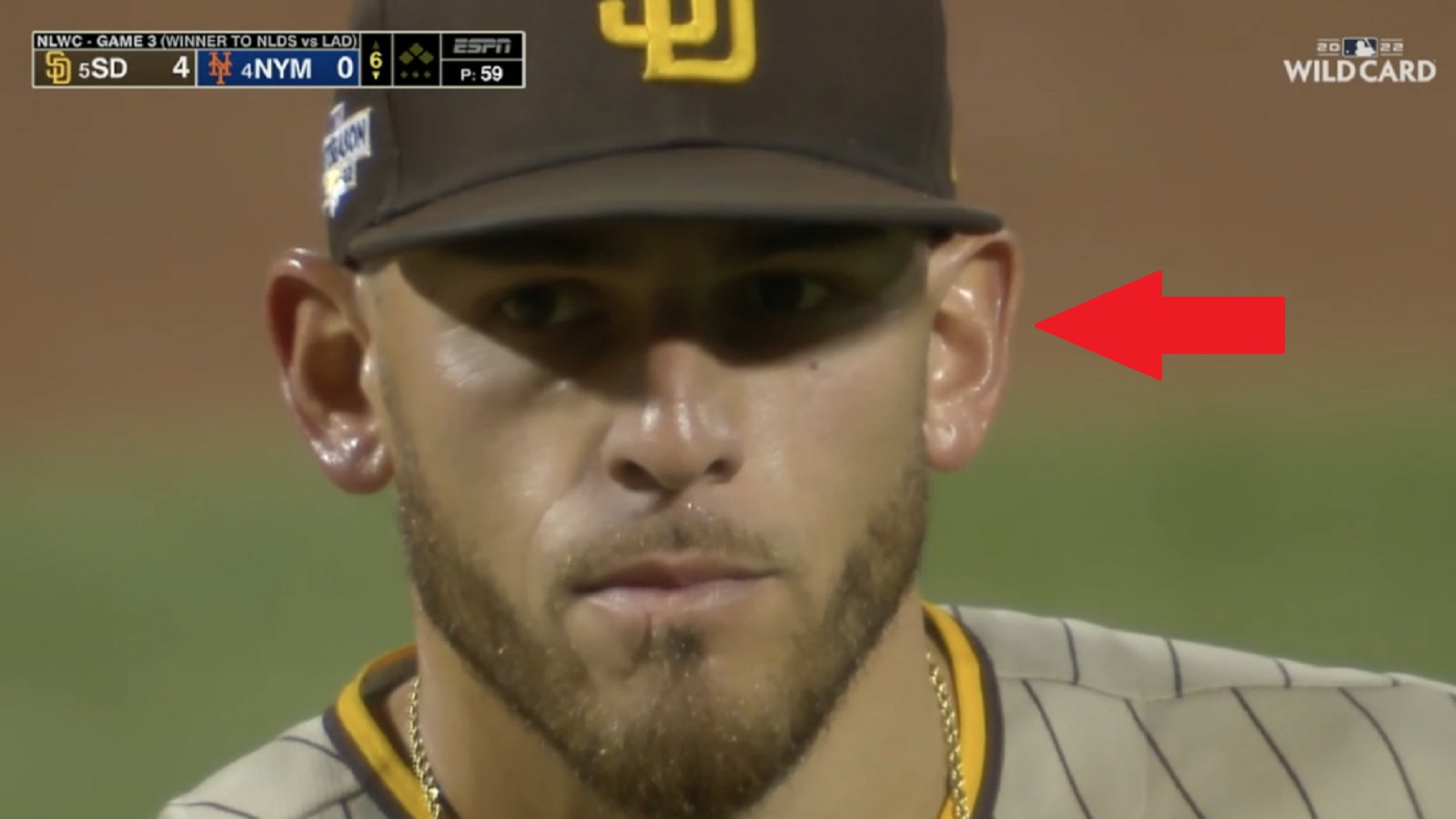 Joe Musgrove's shiny ears could be due to Red Hot ointment, MLB star claims