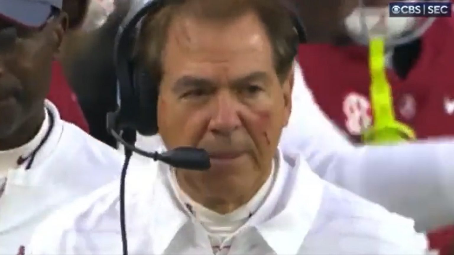 Nick Saban has blood on his face during Iron Bowl