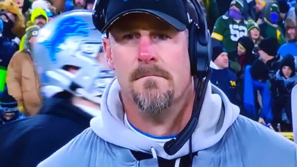 Dan Campbell and his red nose