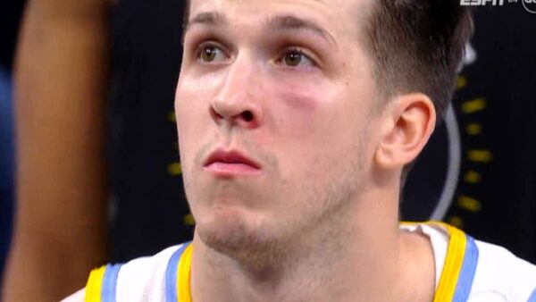 Austin Reaves with swelling under his eye