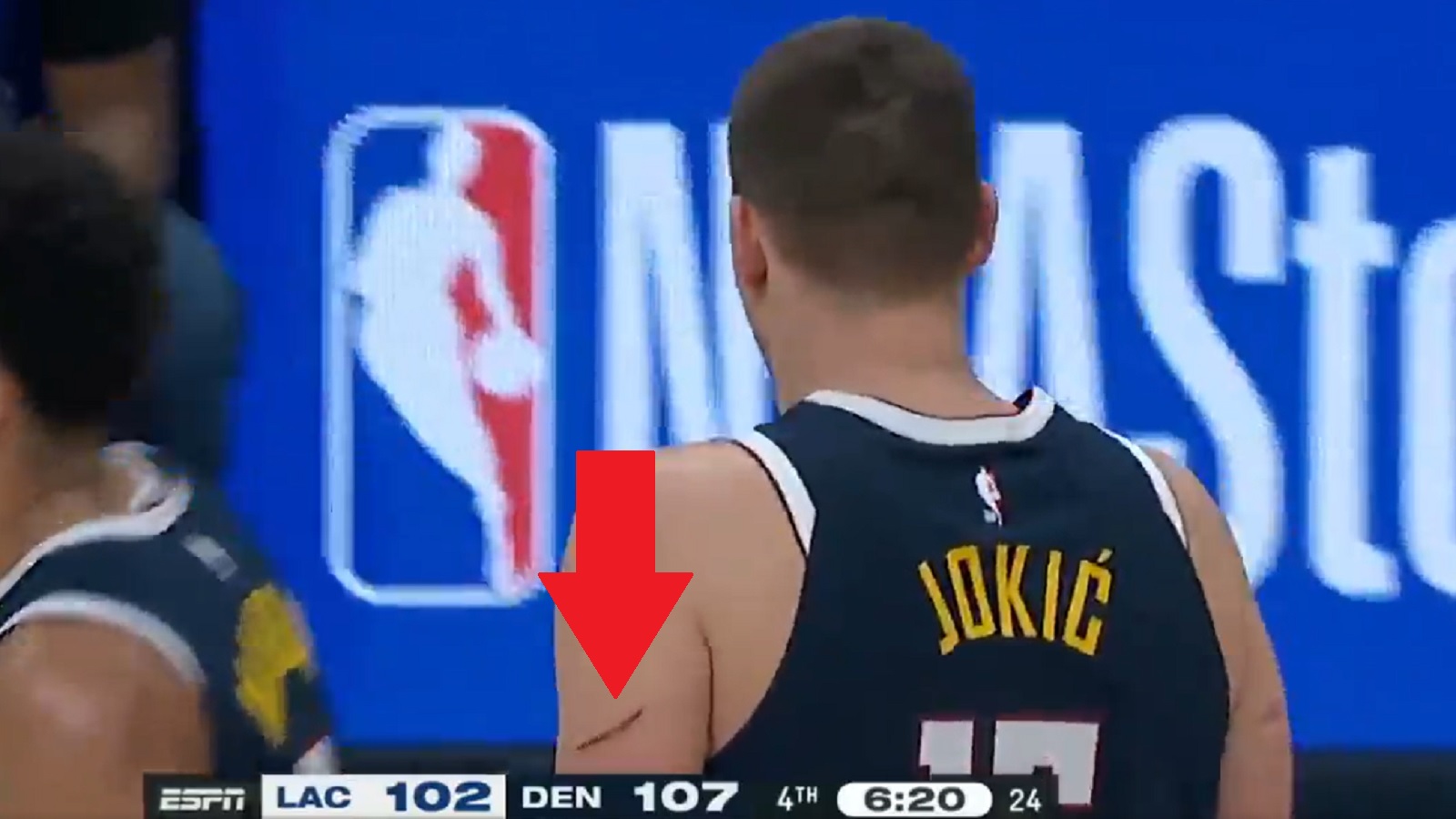 Nikola Jokic plays with scratched up arms against Clippers