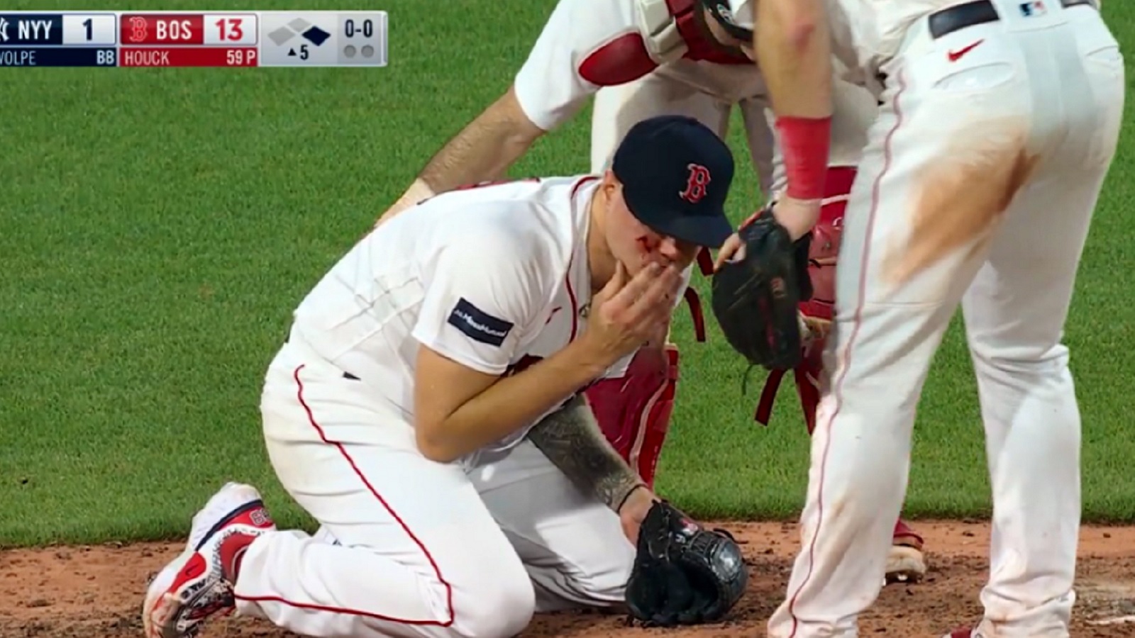Red Sox pitcher avoids serious injury despite being hit by ball in