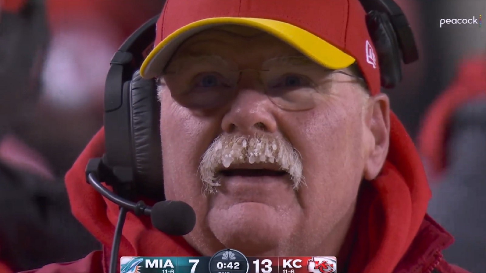 Andy Reid's mustache freezes during cold Chiefs-Dolphins game