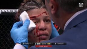 Mayra Bueno Silva with a huge cut at UFC 303